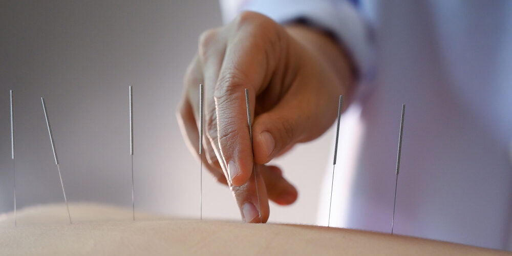 acupuncture-women-who-are-back-acupuncture-treatment-salon